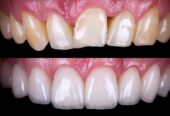 Dentovilla Multi Speciality Dental Clinic
