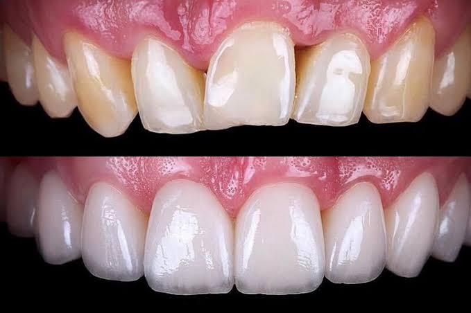 Dentovilla Multi Speciality Dental Clinic